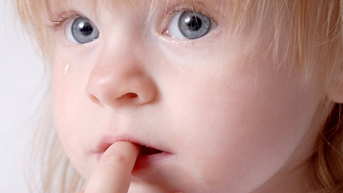 Troubles Oculaires Chez Bebe Les Traitements Parents Fr Troubles Oculaires Chez Bebe Les Traitements Parents Fr