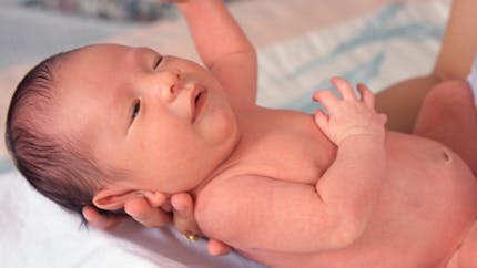 Tout savoir sur les taches de naissance chez le bébé