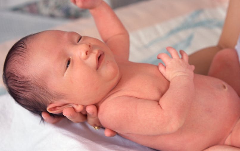 Taches De Naissance Tout Ce Qu Il Faut Savoir Parents Fr Taches De Naissance Tout Ce Qu Il Faut Savoir Parents Fr