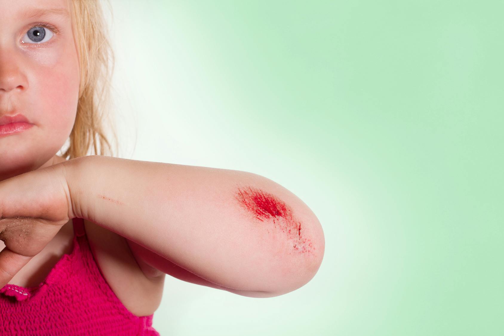 Gestes Premiers Secours Pour Soigner Son Enfant Parents Fr