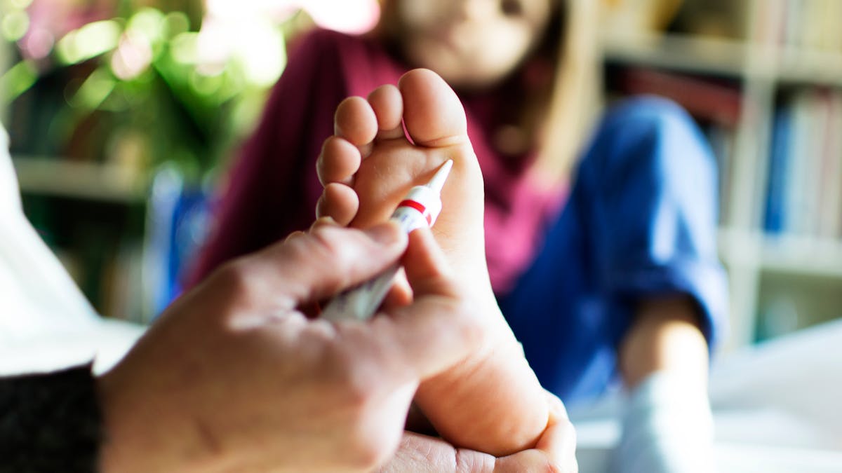 Verrues Chez L Enfant Causes Traitements Astuces Parents Fr Verrues Chez L Enfant Causes Traitements Astuces Parents Fr