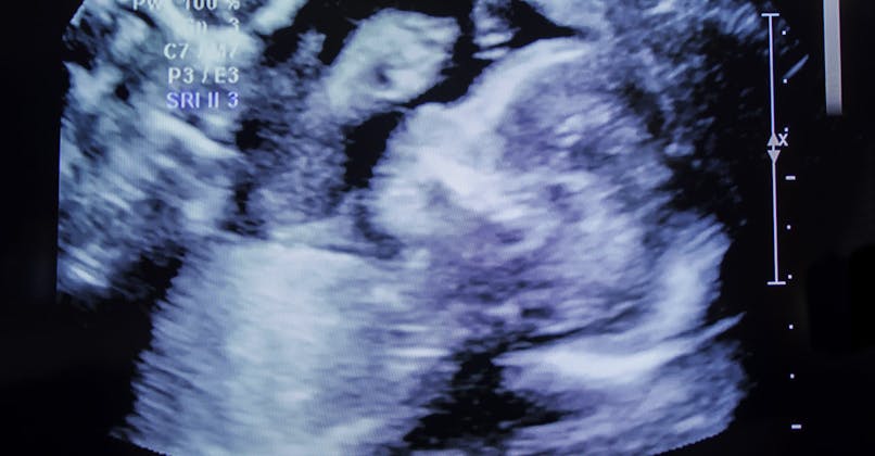 L Echographie Pendant La Grossesse Parents Fr L Echographie Pendant La Grossesse Parents Fr