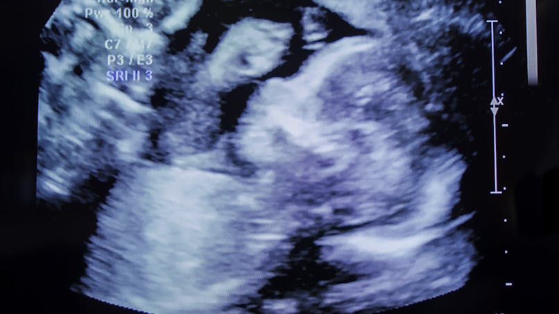 L Echographie Pendant La Grossesse Parents Fr L Echographie Pendant La Grossesse Parents Fr