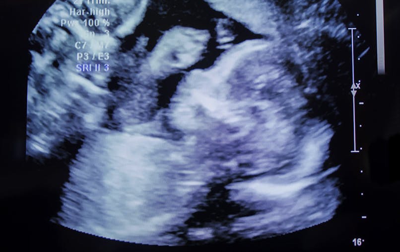 L Echographie Pendant La Grossesse Parents Fr L Echographie Pendant La Grossesse Parents Fr