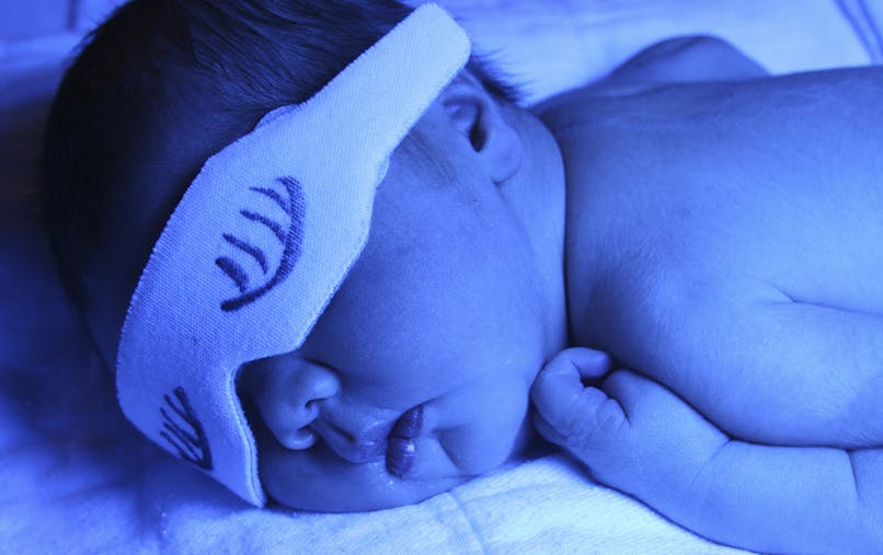 La Jaunisse Du Nourrisson Sante Bebe Parents Fr La Jaunisse Du Nourrisson Sante Bebe Parents Fr