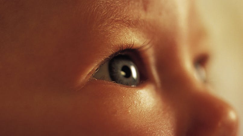 Bebe Louche Le Strabisme Chez L Enfant Parents Fr Bebe Louche Le Strabisme Chez L Enfant Parents Fr