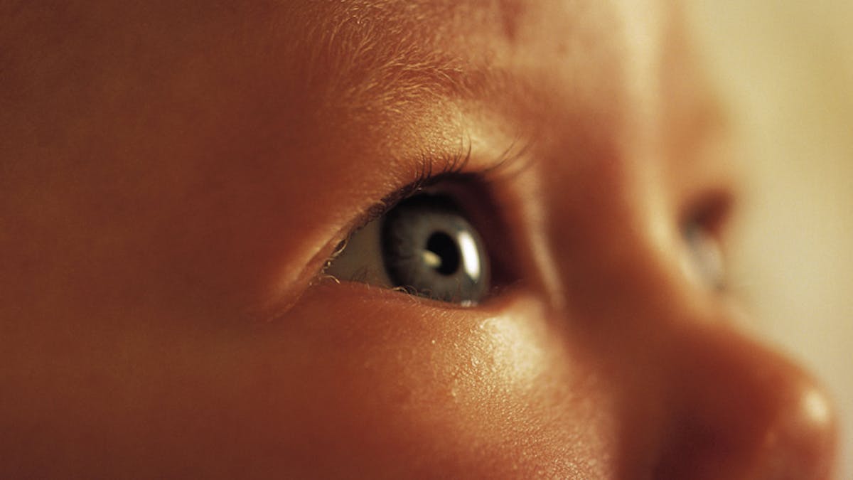 Bebe Louche Le Strabisme Chez L Enfant Parents Fr Bebe Louche Le Strabisme Chez L Enfant Parents Fr
