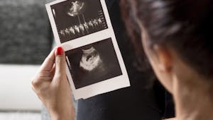 Qu’est-ce que la clarté nucale du foetus ?