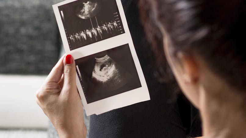 Clarte Nucale Et Trisomie 21 Tout Sur Cet Examen Parents Fr Clarte Nucale Et Trisomie 21 Tout Sur Cet Examen Parents Fr