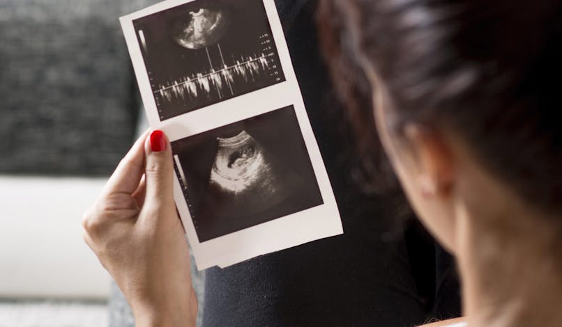 Qu’est-ce que la clarté nucale du foetus ?