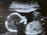 RCIU grossesse : zoom sur le retard de croissance intra-utérin du fœtus