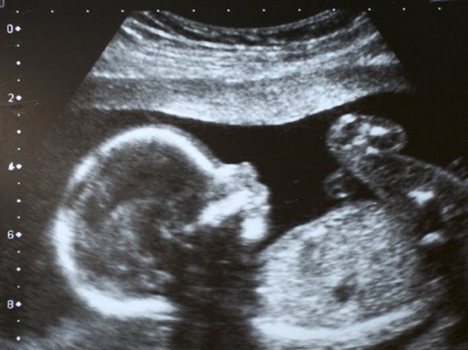 Le test d'évaluation du bien-être fœtal : qu'est-ce que c'est ? - Bébés et  Mamans