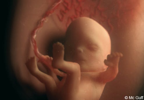 Le Fœtus En Images Evolution Du Fœtus Dans Le Ventre De Sa Mere Mois Par Mois 1 2 Mois 3 4 Mois Parents Fr Le Fœtus En Images Evolution Du Fœtus Dans Le Ventre De Sa Mere Mois Par Mois 1 2 Mois 3 4 Mois Parents Fr