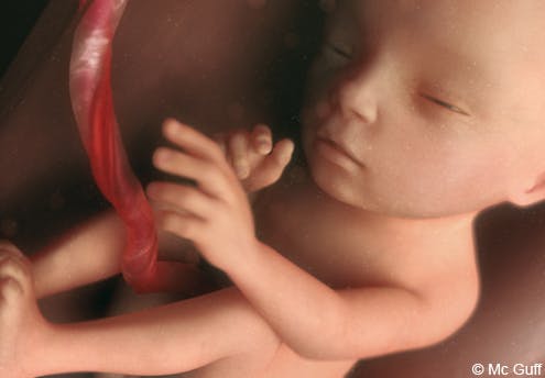 Le Fœtus En Images Evolution Du Fœtus Dans Le Ventre De Sa Mere Mois Par Mois 1 2 Mois 3 4 Mois Parents Fr Le Fœtus En Images Evolution Du Fœtus Dans Le Ventre De Sa Mere Mois Par Mois 1 2 Mois 3 4 Mois Parents Fr