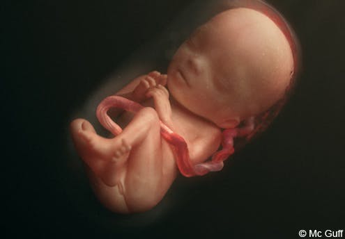 Le Fœtus En Images Evolution Du Fœtus Dans Le Ventre De Sa Mere Mois Par Mois 1 2 Mois 3 4 Mois Parents Fr Le Fœtus En Images Evolution Du Fœtus Dans Le Ventre De Sa Mere Mois Par Mois 1 2 Mois 3 4 Mois Parents Fr