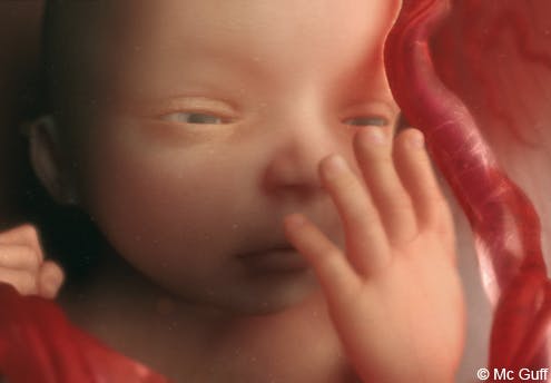 Le Fœtus En Images Evolution Du Fœtus Dans Le Ventre De Sa Mere Mois Par Mois 1 2 Mois 3 4 Mois Parents Fr Le Fœtus En Images Evolution Du Fœtus Dans Le Ventre De Sa Mere Mois Par Mois 1 2 Mois 3 4 Mois Parents Fr