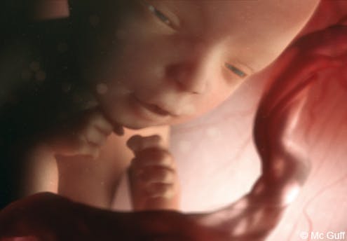 Le Fœtus En Images Evolution Du Fœtus Dans Le Ventre De Sa Mere Mois Par Mois 1 2 Mois 3 4 Mois Parents Fr Le Fœtus En Images Evolution Du Fœtus Dans Le Ventre De Sa Mere Mois Par Mois 1 2 Mois 3 4 Mois Parents Fr