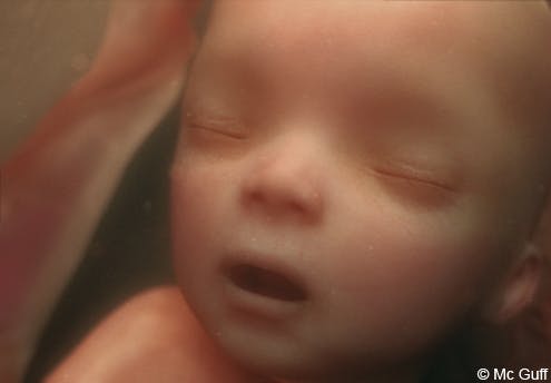 Le Fœtus En Images Evolution Du Fœtus Dans Le Ventre De Sa Mere Mois Par Mois 1 2 Mois 3 4 Mois Parents Fr Le Fœtus En Images Evolution Du Fœtus Dans Le Ventre De Sa Mere Mois Par Mois 1 2 Mois 3 4 Mois Parents Fr