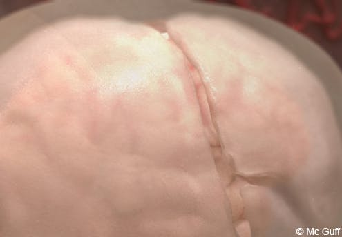 8 mois : à quoi ressemble de cerveau de Bébé ?