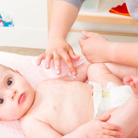 Les Soins De La Peau De Bebe Irritation De La Peau De Bebe Parents Fr Les Soins De La Peau De Bebe Irritation De La Peau De Bebe Parents Fr