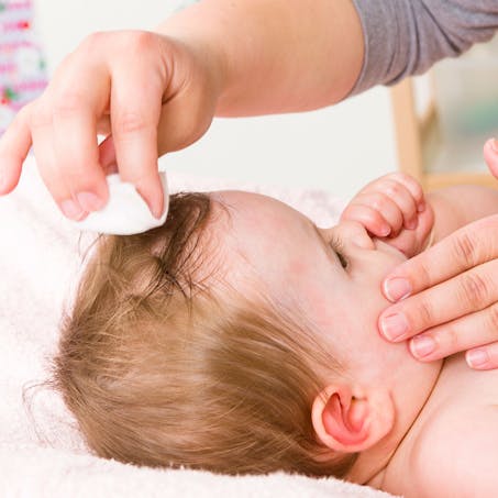 Les Soins De La Peau De Bebe Irritation De La Peau De Bebe Parents Fr Les Soins De La Peau De Bebe Irritation De La Peau De Bebe Parents Fr