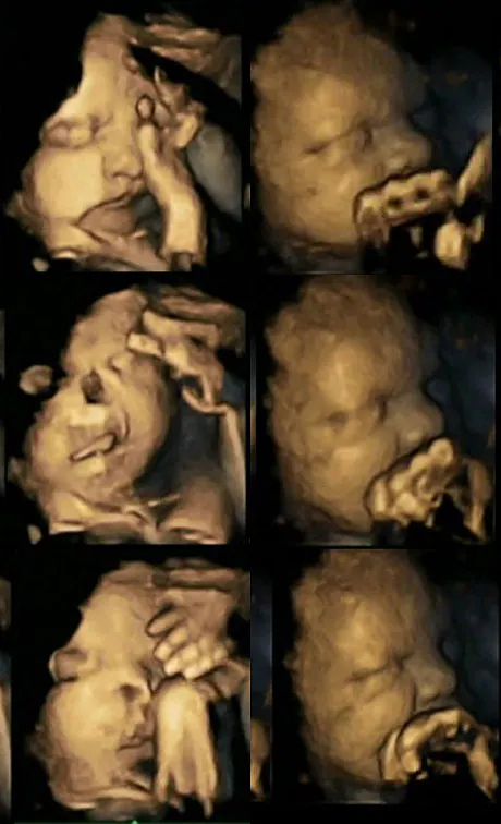PHOTO - Grossesse : ll'impact du tabac sur le foetus | Parents.fr PHOTO - Grossesse : ll'impact du tabac sur le foetus | Parents.fr