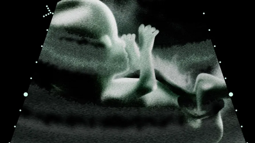 PHOTO - Grossesse : ll'impact du tabac sur le foetus | Parents.fr PHOTO - Grossesse : ll'impact du tabac sur le foetus | Parents.fr