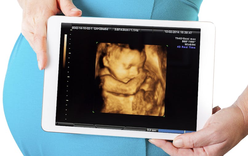 Echographie 3d A Quoi Ca Sert Parents Fr Echographie 3d A Quoi Ca Sert Parents Fr