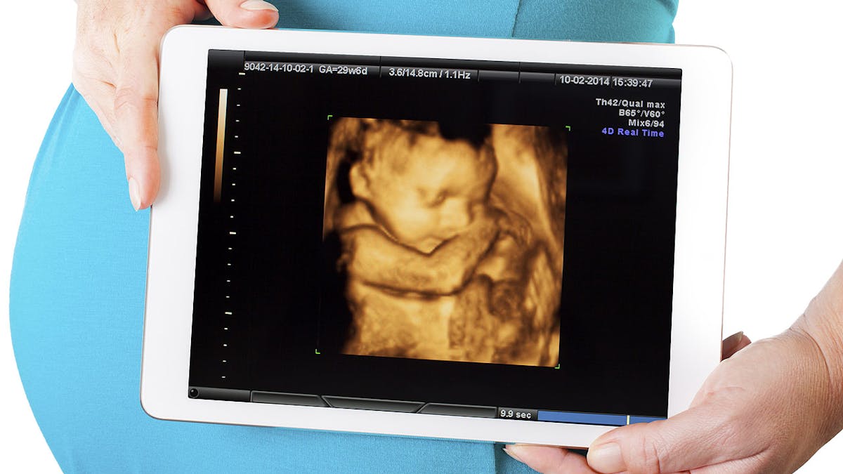 Echographie 3d A Quoi Ca Sert Parents Fr Echographie 3d A Quoi Ca Sert Parents Fr