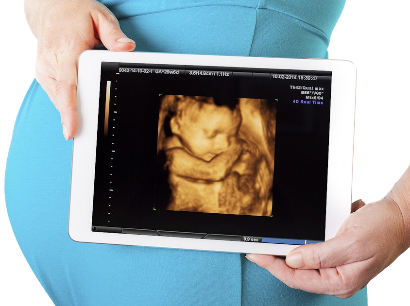 Echographie 3D, à quoi ça sert ? - PARENTS.fr