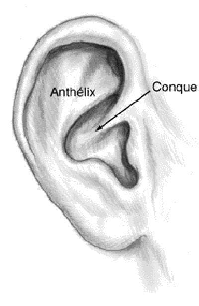 Otoplastie Chez L Enfant Oreilles Decolees Parents Fr Otoplastie Chez L Enfant Oreilles Decolees Parents Fr