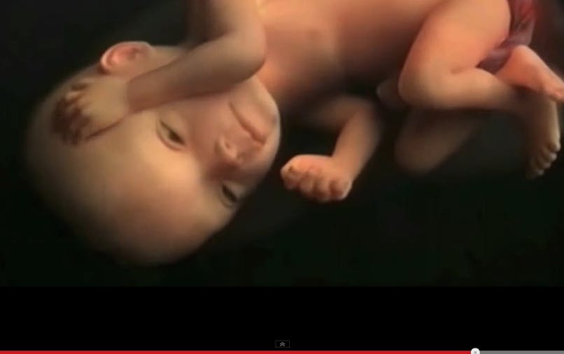 Bebe In Utero Une Video Epoustouflante Parents Fr Bebe In Utero Une Video Epoustouflante Parents Fr