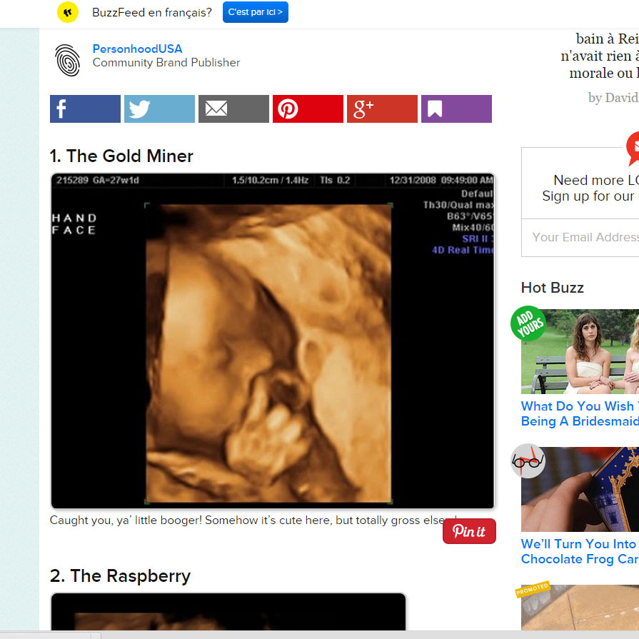 Fœtus 10 Echographies Incroyables Parents Fr