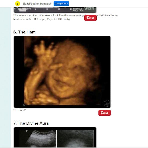 Fœtus 10 Echographies Incroyables Parents Fr Fœtus 10 Echographies Incroyables Parents Fr