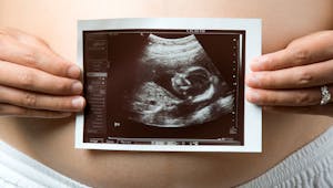 Fœtus : 10 échographies insolites