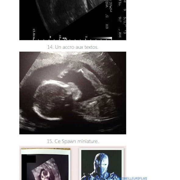 Fœtus 10 Echographies Incroyables Parents Fr Fœtus 10 Echographies Incroyables Parents Fr