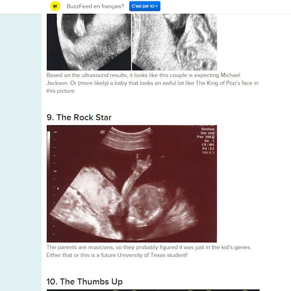 Fœtus 10 Echographies Incroyables Parents Fr Fœtus 10 Echographies Incroyables Parents Fr