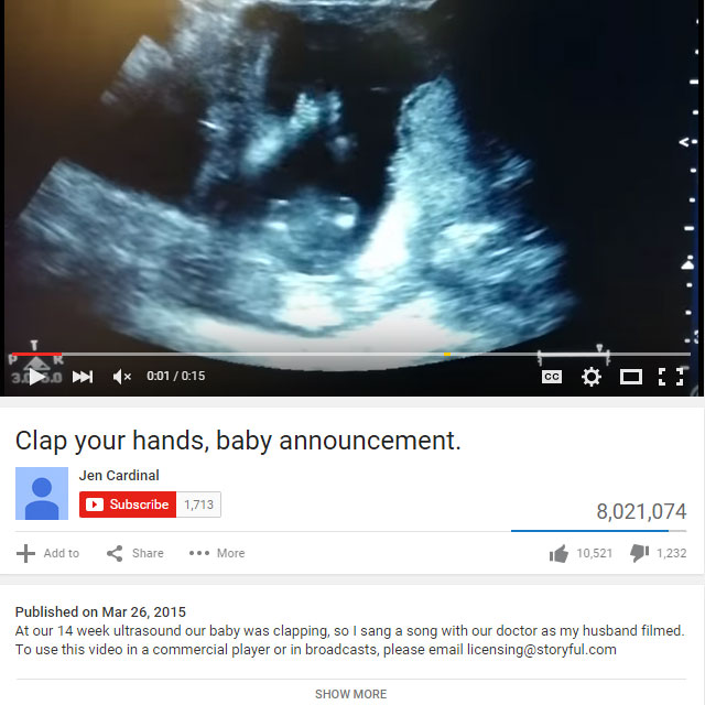 Fœtus 10 Echographies Incroyables Parents Fr