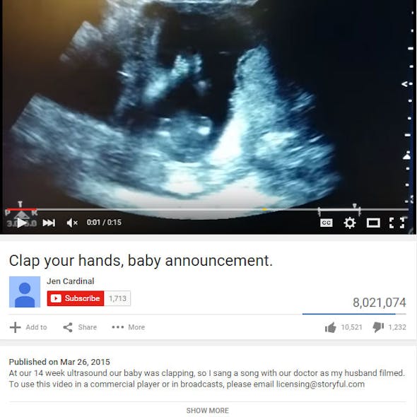 Fœtus 10 Echographies Incroyables Parents Fr Fœtus 10 Echographies Incroyables Parents Fr