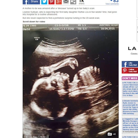 Fœtus 10 Echographies Incroyables Parents Fr Fœtus 10 Echographies Incroyables Parents Fr