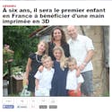 Un petit Français de 6 ans reçoit une prothèse de main
  imprimée en 3D