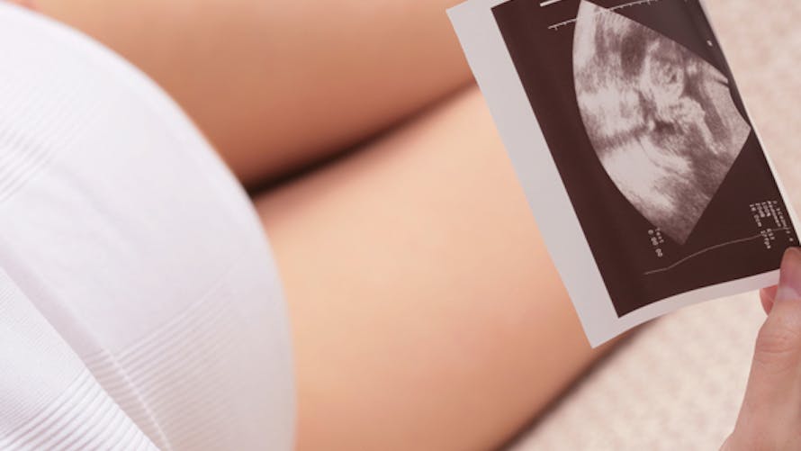 L'échographie pour prévenir le risque d’accouchement
  prématuré