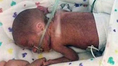 Un Bebe Ne Prematurement Dans Un Bateau Reussit A Survivre Parents Fr Un Bebe Ne Prematurement Dans Un Bateau Reussit A Survivre Parents Fr