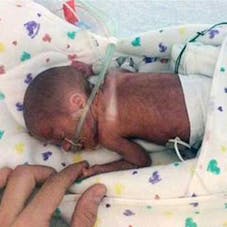 Un Bebe Ne Prematurement Dans Un Bateau Reussit A Survivre Parents Fr