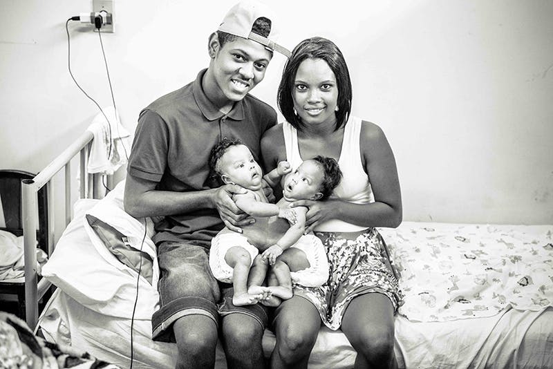 10 Magnifiques Photos De Bebes Siamois Parents Fr 10 Magnifiques Photos De Bebes Siamois Parents Fr