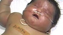 Inde : elle donne naissance au plus gros bébé du  monde