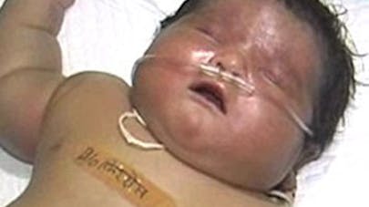 Une Indienne Donne Naissance Au Plus Gros Bebe Du Monde Parents Fr Une Indienne Donne Naissance Au Plus Gros Bebe Du Monde Parents Fr