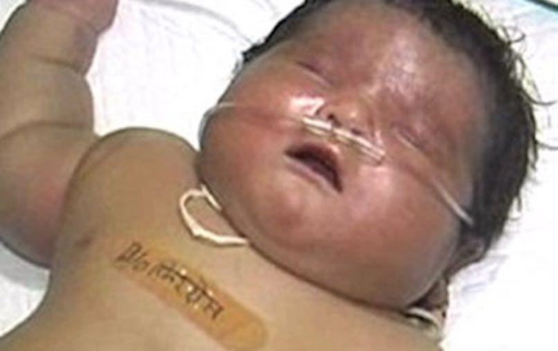 Une Indienne Donne Naissance Au Plus Gros Bebe Du Monde Parents Fr Une Indienne Donne Naissance Au Plus Gros Bebe Du Monde Parents Fr