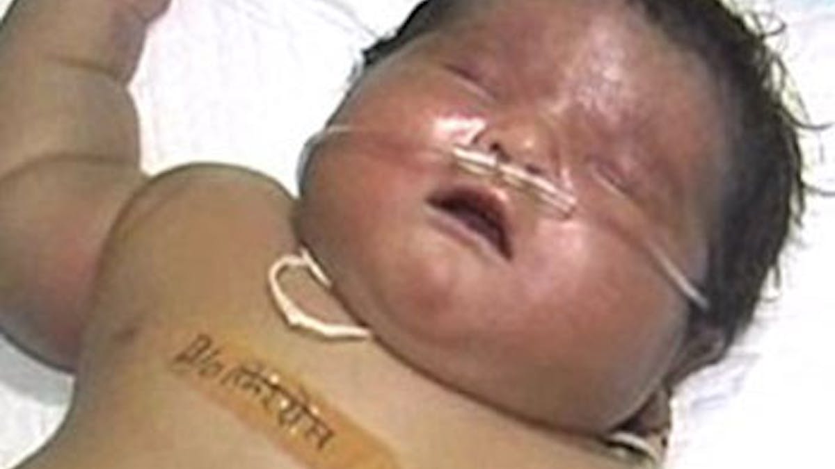 Une Indienne Donne Naissance Au Plus Gros Bebe Du Monde Parents Fr Une Indienne Donne Naissance Au Plus Gros Bebe Du Monde Parents Fr