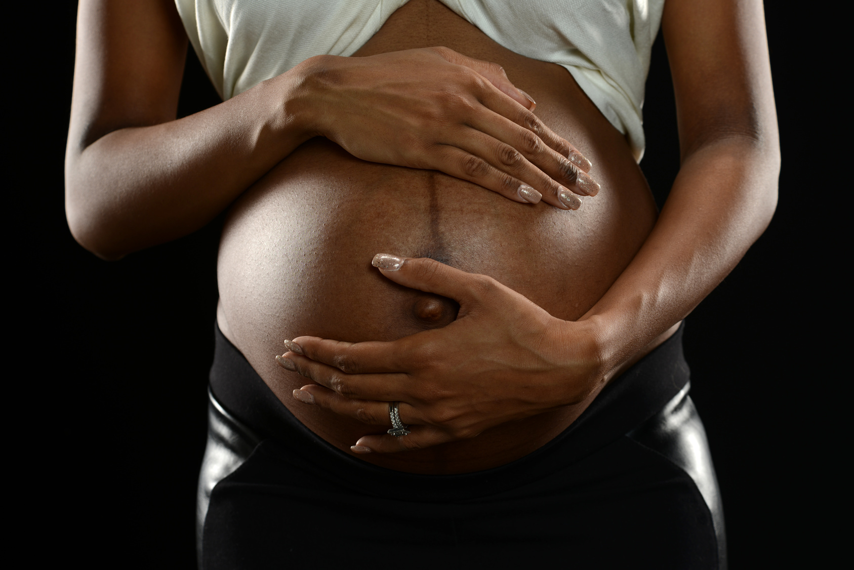 Grossesse et peau noire – Eviter ou traiter vergetures et masque de  grossesse | PARENTS.fr
